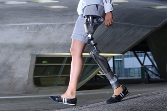 Hanche prothétique avec paliers lisses iglidur® de la société Otto Bock HealthCare GmbH (Allemagne)